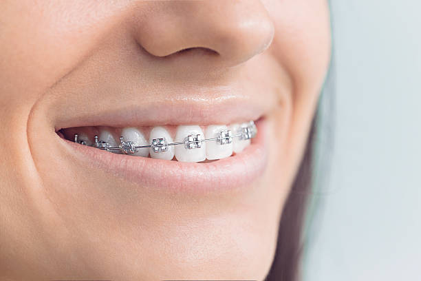 Best Veneers and Lumineers  in St Pete Beach, FL